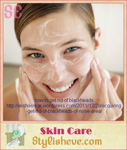 how to get rid of blackheads 5 (c) akshikinkar how to get rid of sweat