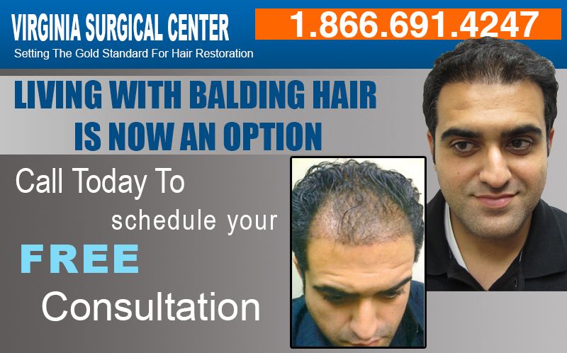 hair photo:signs of hair loss 